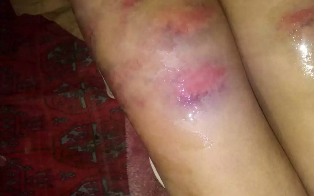 چارباغ میں سکول استاد نے دوسری کلاس کے شاگرد پر تشدد کر کے  شدیدزخمی کردیا