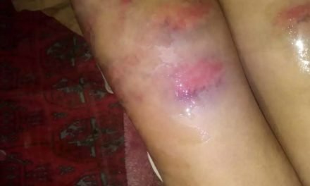 چارباغ میں سکول استاد نے دوسری کلاس کے شاگرد پر تشدد کر کے  شدیدزخمی کردیا