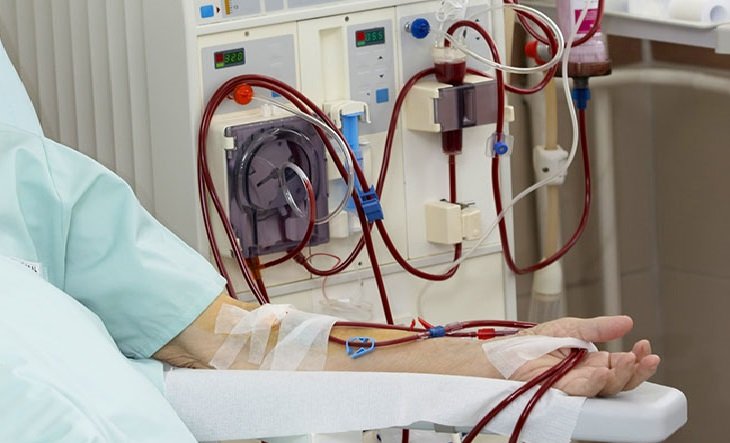 گھر پر بغیر تکلیف ڈائیلاسس کرنے والی پاکستان کی پہلی مشین تیار
